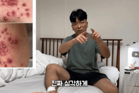 在暹粒花5美元按摩 韩国网红脚部发炎被迫手术